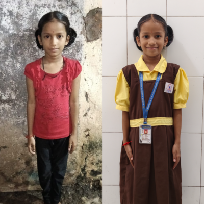 Before & After Admission photo of Bhoomika Kavithiya – 4th B Before & After Admission photo of Bhoomika Kavithiya – 4th B