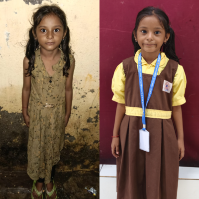 Before & After Admission photo of Riya Waghela - 2nd B Before & After Admission photo of Riya Waghela - 2nd B